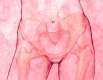 Опущення матки і органів малого таза: 5 вправ, які допоможуть