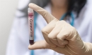 Эпидемия коронавируса замедляется, человечество выживет, говорит биофизик Майкл Левитт