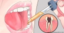 Как снять любую зубную боль за несколько секунд