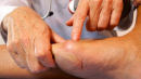 Шишка на нозі: причини появи, тривожні симптоми і методи лікування