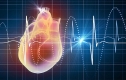 Тахікардія: Що робити при прискореному серцебитті