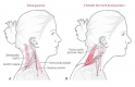 Кисточки: Упражнение, которое вернет молодость вашей шее и лицу