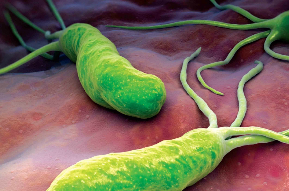 H. Pylori: факты о язвенной болезни желудка H. Pylori: факты о язвенной болезни желудка