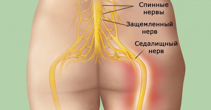Попрощайтесь с болью в спине! Достижение успеха в 95 % случаев! Попрощайтесь с болью в спине! Достижение успеха в 95 % случаев!
