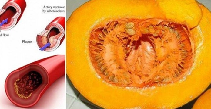  До свидания холестерин, глюкоза в крови, липиды и триглицериды 