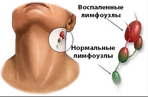 Насколько мы ничего не знаем о лимфатической системе Насколько мы ничего не знаем о лимфатической системе