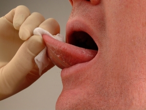 Причини появи прищів на язиці