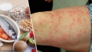 Распространённые пищевые аллергены и продукты для их замены Распространённые пищевые аллергены и продукты для их замены
