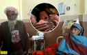 Рідкісний випадок: в Індії виявили саму літню породіллю