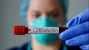 Коронавірус дельта-штаму показує, що інфекція отримала нові властивості – лікар
