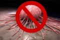 Італійський лікар-онколог: Рак – це грибок, лікувати його дуже просто!