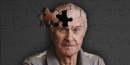 Болезнь Альцгеймера. Нетрадиционное лечение и профилактика: ответы эксперта