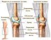 Рідина в колінному суглобі - лікування