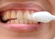 Ученые: желтые зубы – признак здоровья