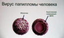 Папіломи на шиї