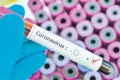 Експертка ЮНІСЕФ розповіла про дезінфекцію під час коронавірусу