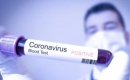 В Італії за добу на коронавірус захворіли майже 2 тисячі осіб