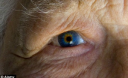 Taking aspirin doubles the risk of blindness in elderly people