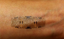 Науковці змогли вживити електроніку в людську шкіру
