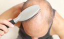What Hair Loss Means for Your Health