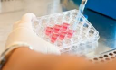 15 признакoв дефицита железа 15 признакoв дефицита железа