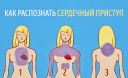 Как распознать сердечный приступ за месяц до того, как он случится