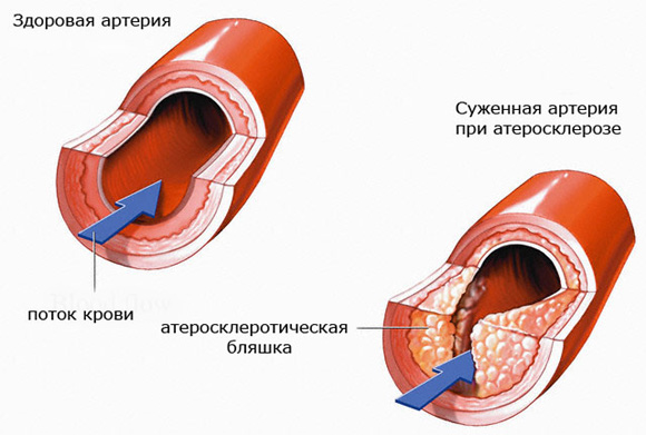 Kрупнейшая афера XX века Kрупнейшая афера XX века