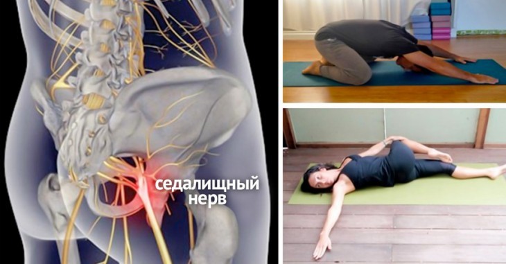8 упражнений и поз из йоги, с которыми вы навсегда забудете о радикулите и болях в спине 8 упражнений и поз из йоги, с которыми вы навсегда забудете о радикулите и болях в спине